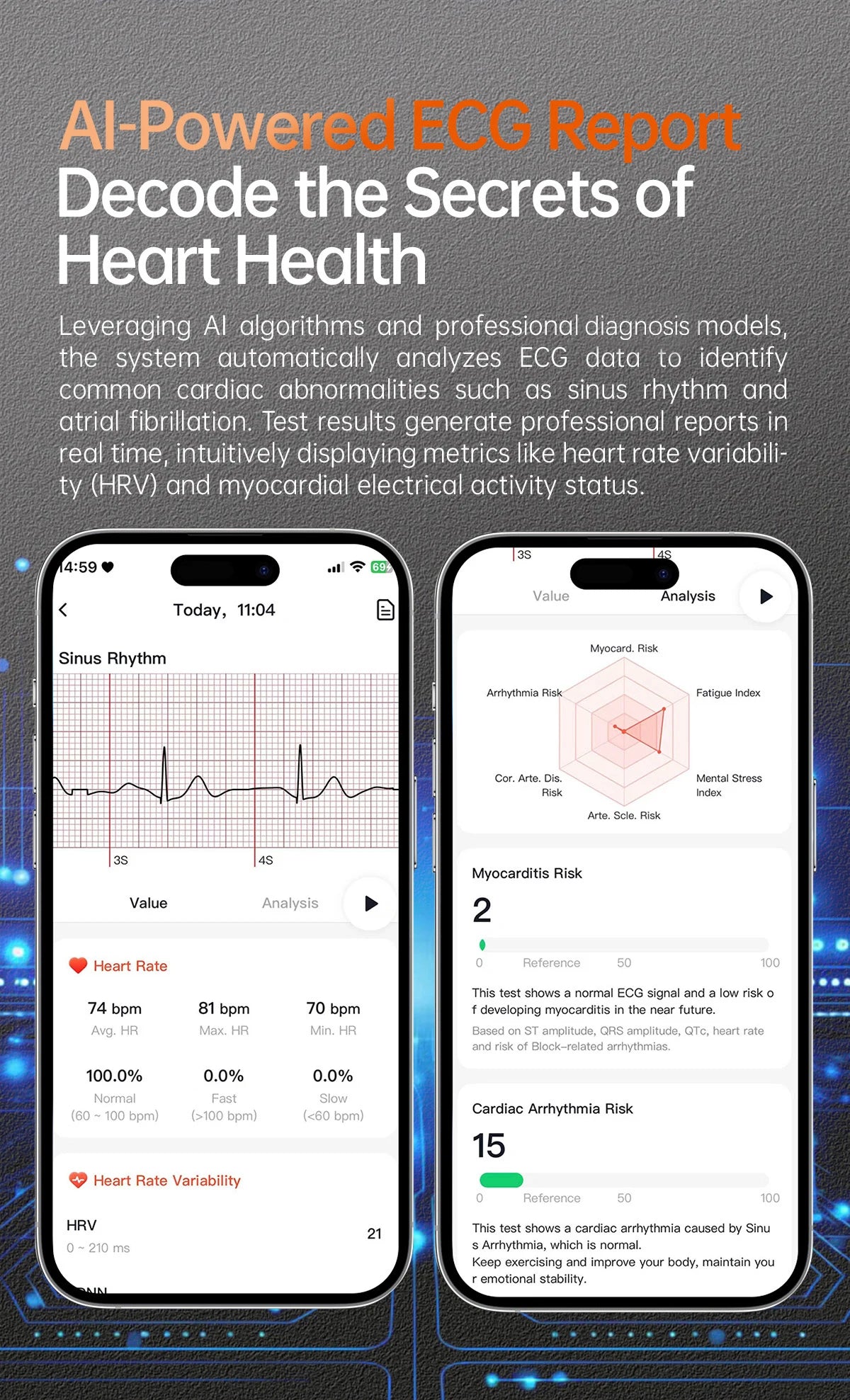 2025 New Health Care ECG+HRV+NFC SmartWatch Body Analysis Uric Acid Blood lipids Heart Rate Blood pressure Monitoring Smartwatch